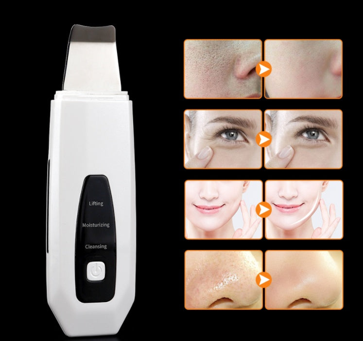✨ Limpiador Facial Ultrasónico de Iones