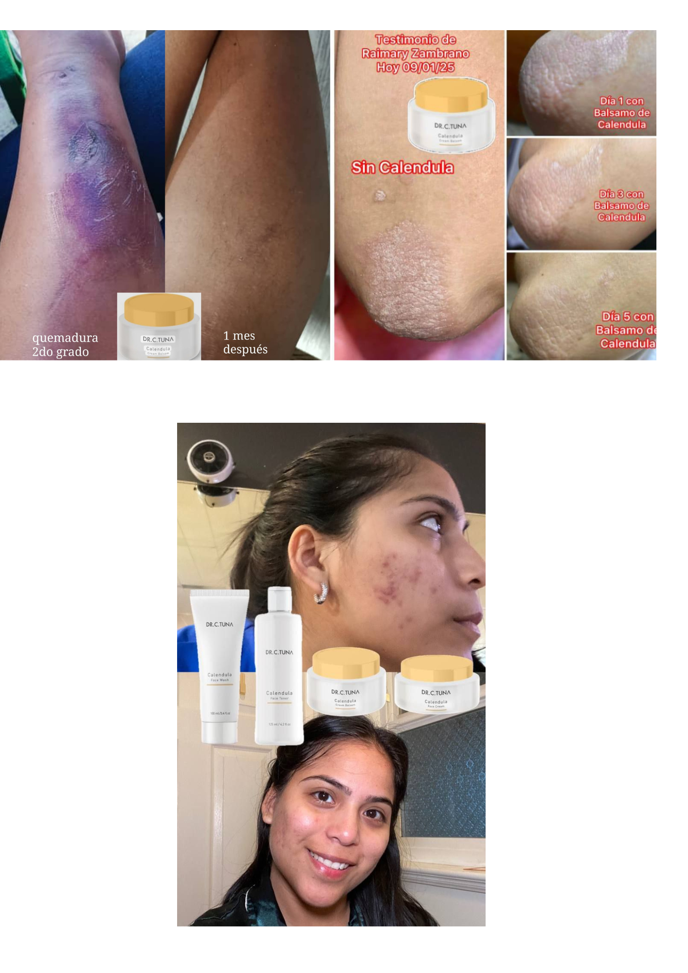 Colección Caléndula – Rutina Hidratante para Piel Seca y Sensible