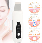 ✨ Limpiador Facial Ultrasónico de Iones