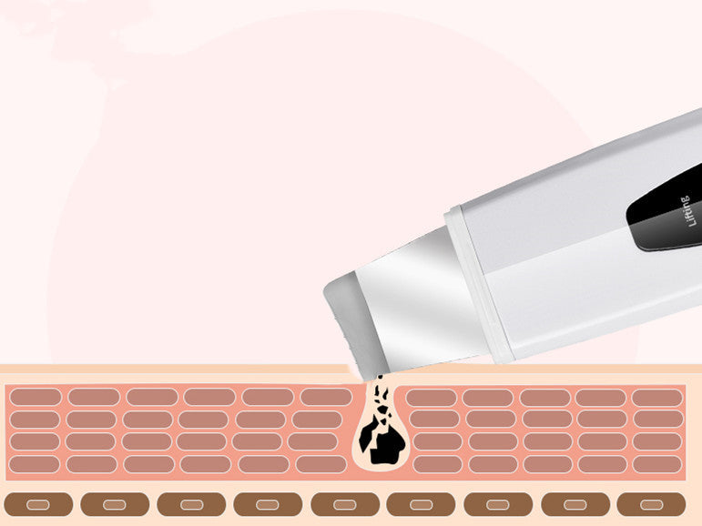 ✨ Limpiador Facial Ultrasónico de Iones